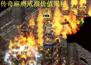 传奇麻痹戒指价值揭秘